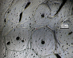 The micrograph of a bovine bone cross-section 