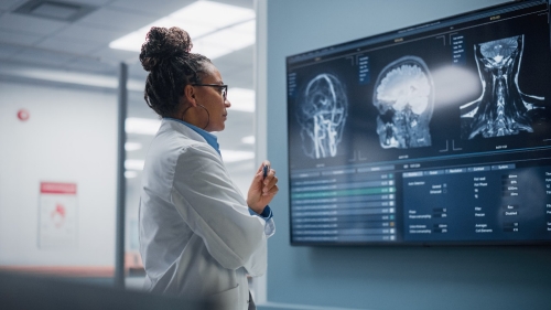 Female in labcoat looking at medical images on screen