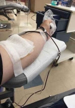 A view of a male arm donating blood.