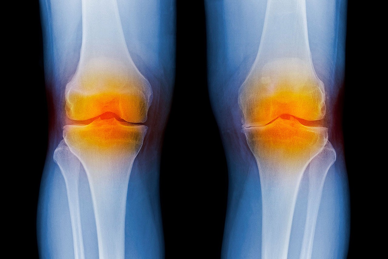 knee X-ray